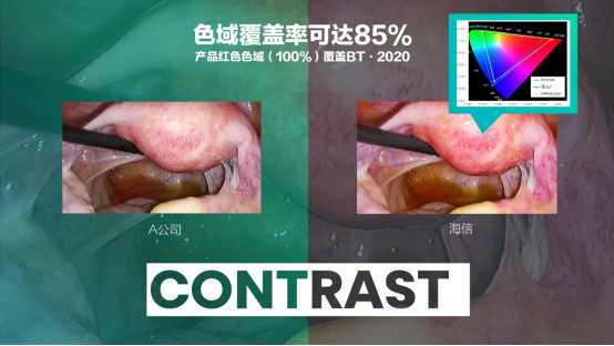 07   海信發布全球首臺55吋Mini-LED醫用內窺顯示器631.png